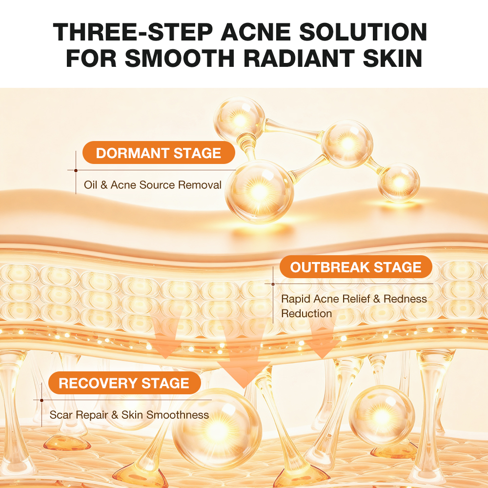 Salicylic Acid Refreshing Acne Skin Body Wash-SKINEVER PH