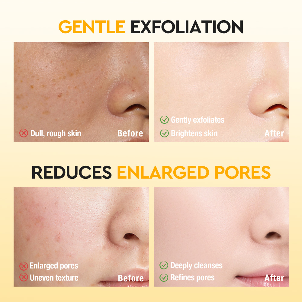 Salicylic Acid Oil Control Makeup Removing Mousse