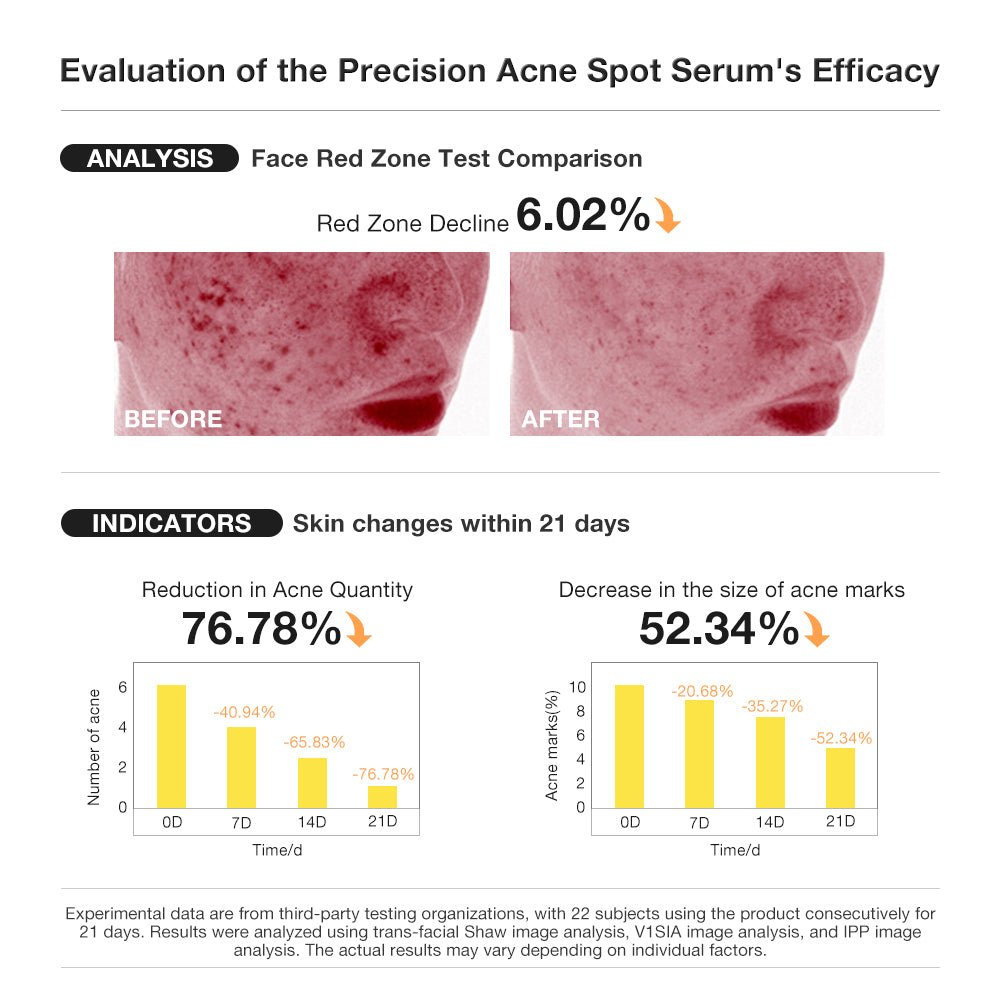 Salicylic Acid Precision Acne Spot Serum-SKINEVER PH