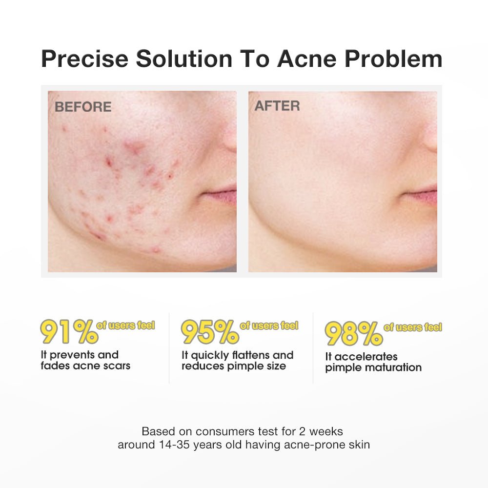 Salicylic Acid Precision Acne Spot Serum-SKINEVER PH