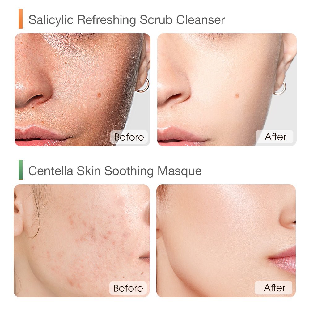 Clarifying & Calming Repair Set-SKINEVER PH