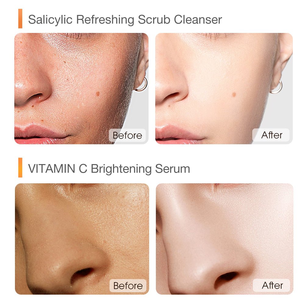 Clear & Brightening Set-SKINEVER PH