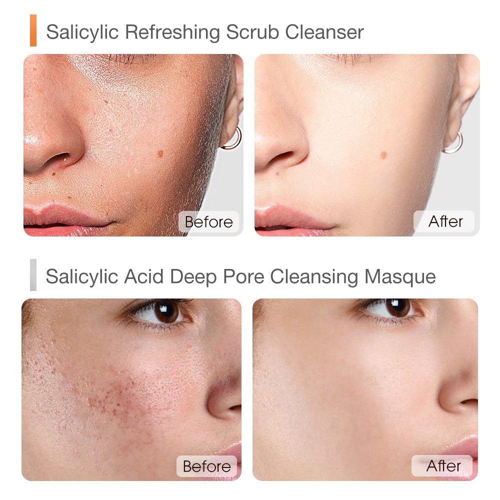 Clear & Radiant Sunscreen Set-SKINEVER PH