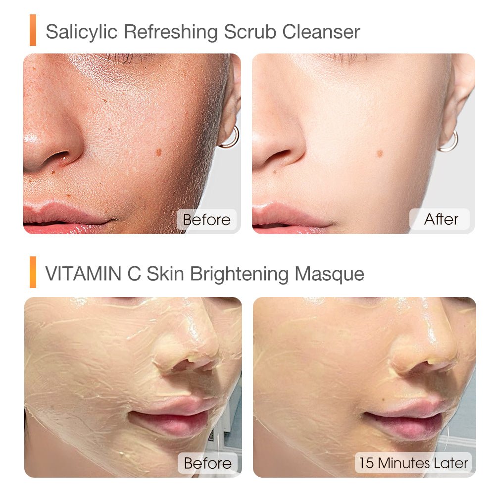 Instant Glow & Cleanse Duo Set-SKINEVER PH