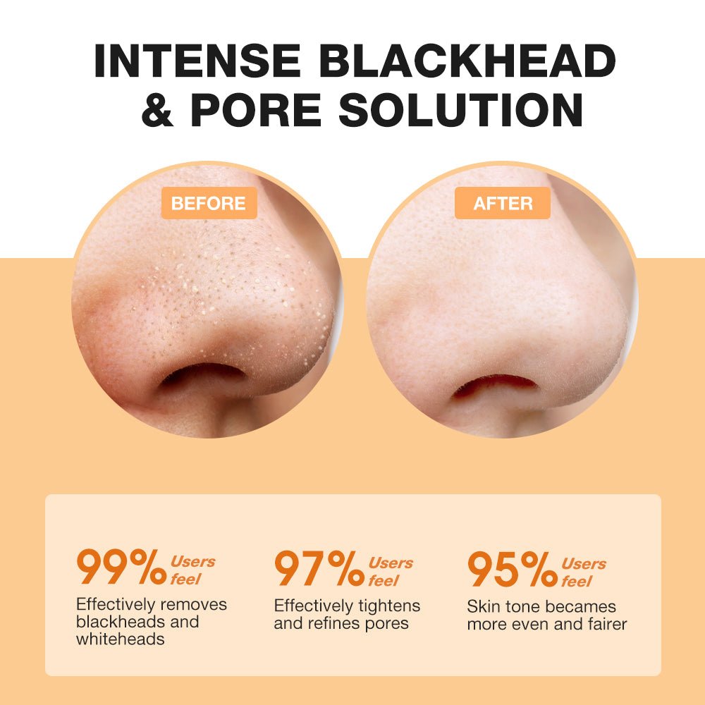 Salicylic Acid Blackhead Purifying & Pore Minimizing Set-SKINEVER PH