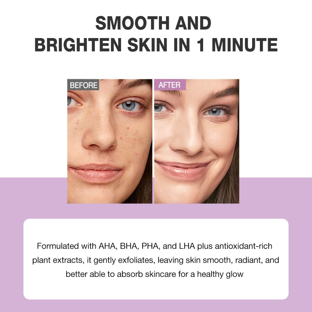 Glycolic Acid Deep Peeling Solution-SKINEVER PH