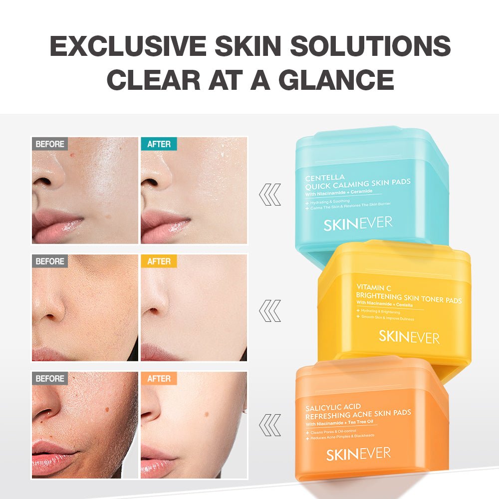3 Types Cotton Pads Salicylic Acid  Vitamin C  Centella-SKINEVER PH