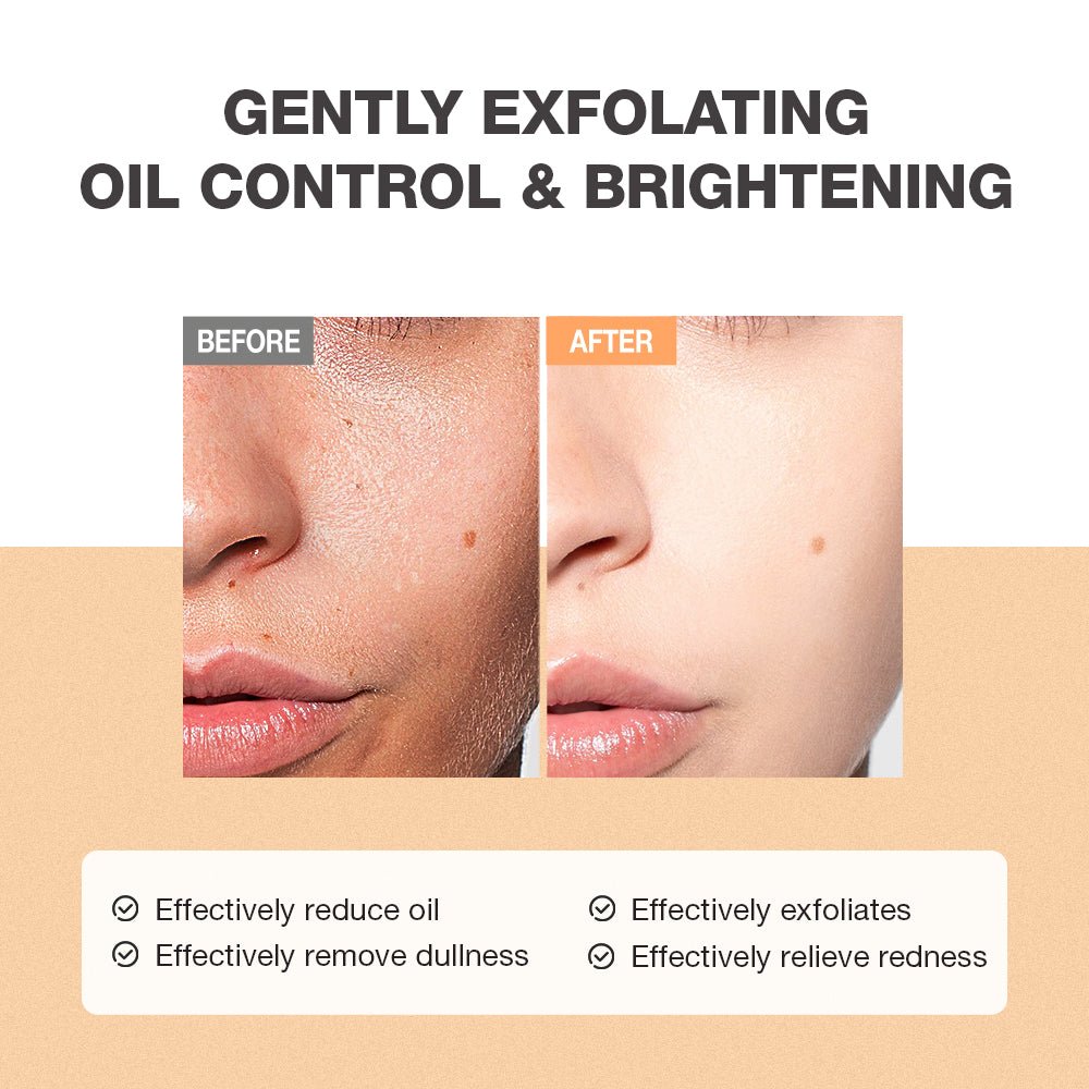 Salicylic Refreshing Scrub Cleanser-Facial wash-SKINEVER PH