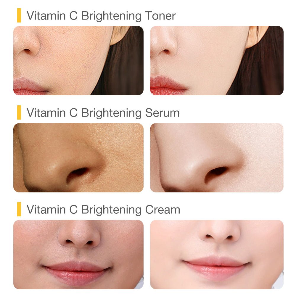 VC Total Brightening Family Set-SKINEVER PH