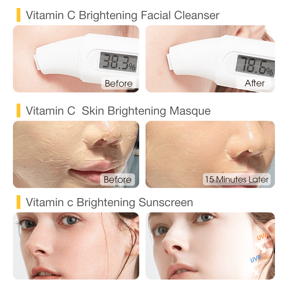 VC Total Brightening Family Set-SKINEVER PH