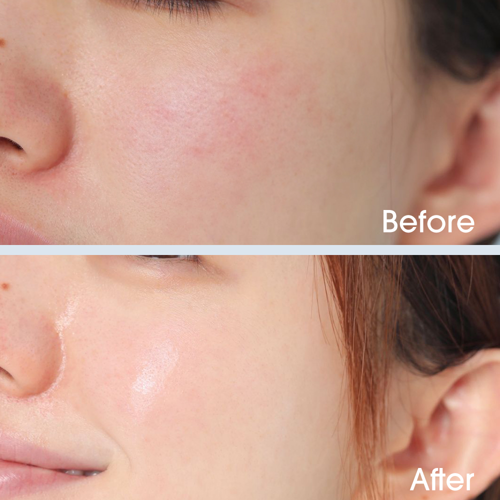 Hyssop Facial Essence Mask Gel-O.TWO.O PH