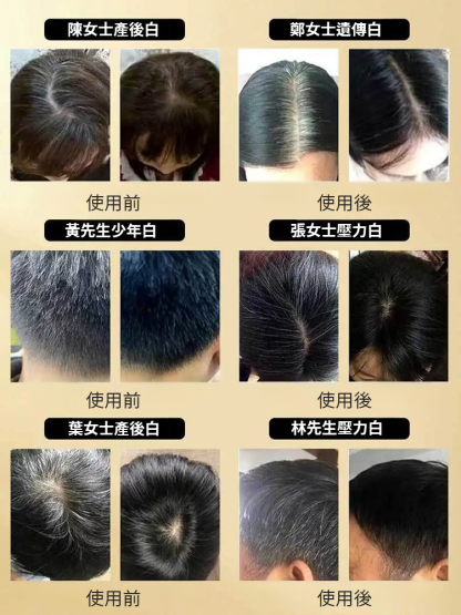 固養黑方湯