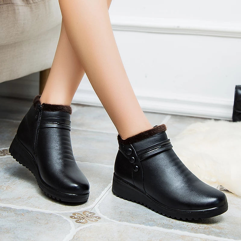 Orthopedic Snow Boots Women Leather Ankle Shoes