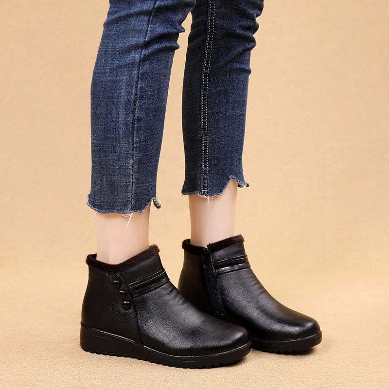 Orthopedic Snow Boots Women Leather Ankle Shoes