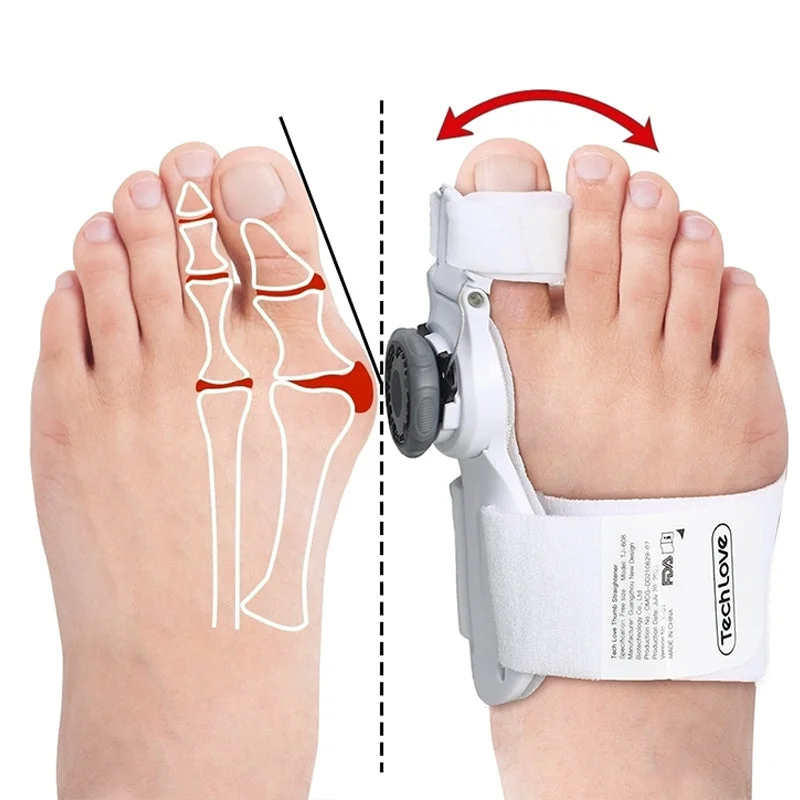 Upgraded Bunion Corrector - 3D Knob Toes Corrector