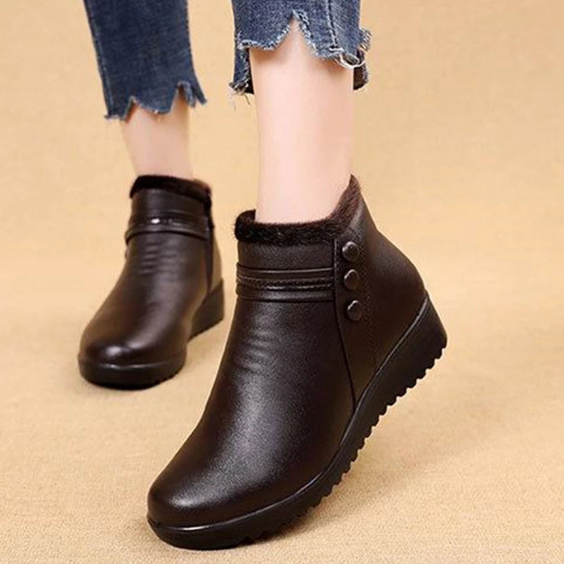 Orthopedic Snow Boots Women Leather Ankle Shoes