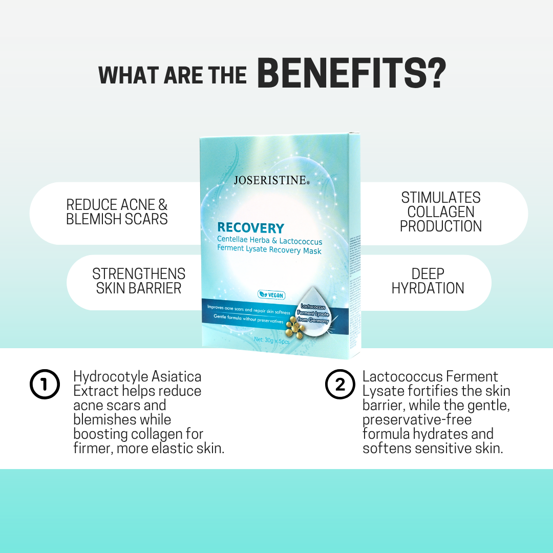 JOSERISTINE Prebiotics + Centella Recovery Face Mask Box Set 5's