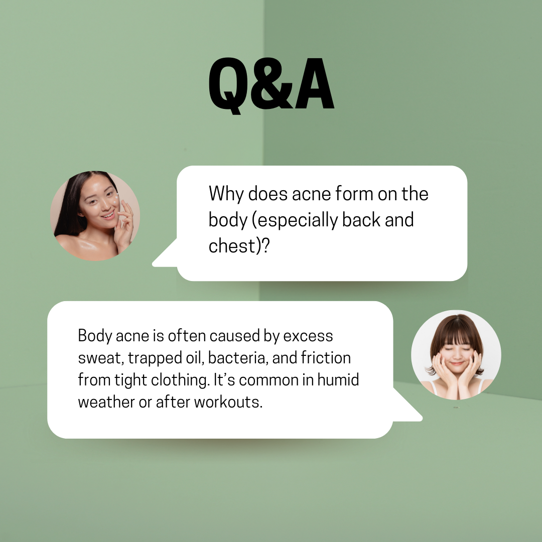 JOSERISTINE Pionin Acne Clear Shower Gel 500ml