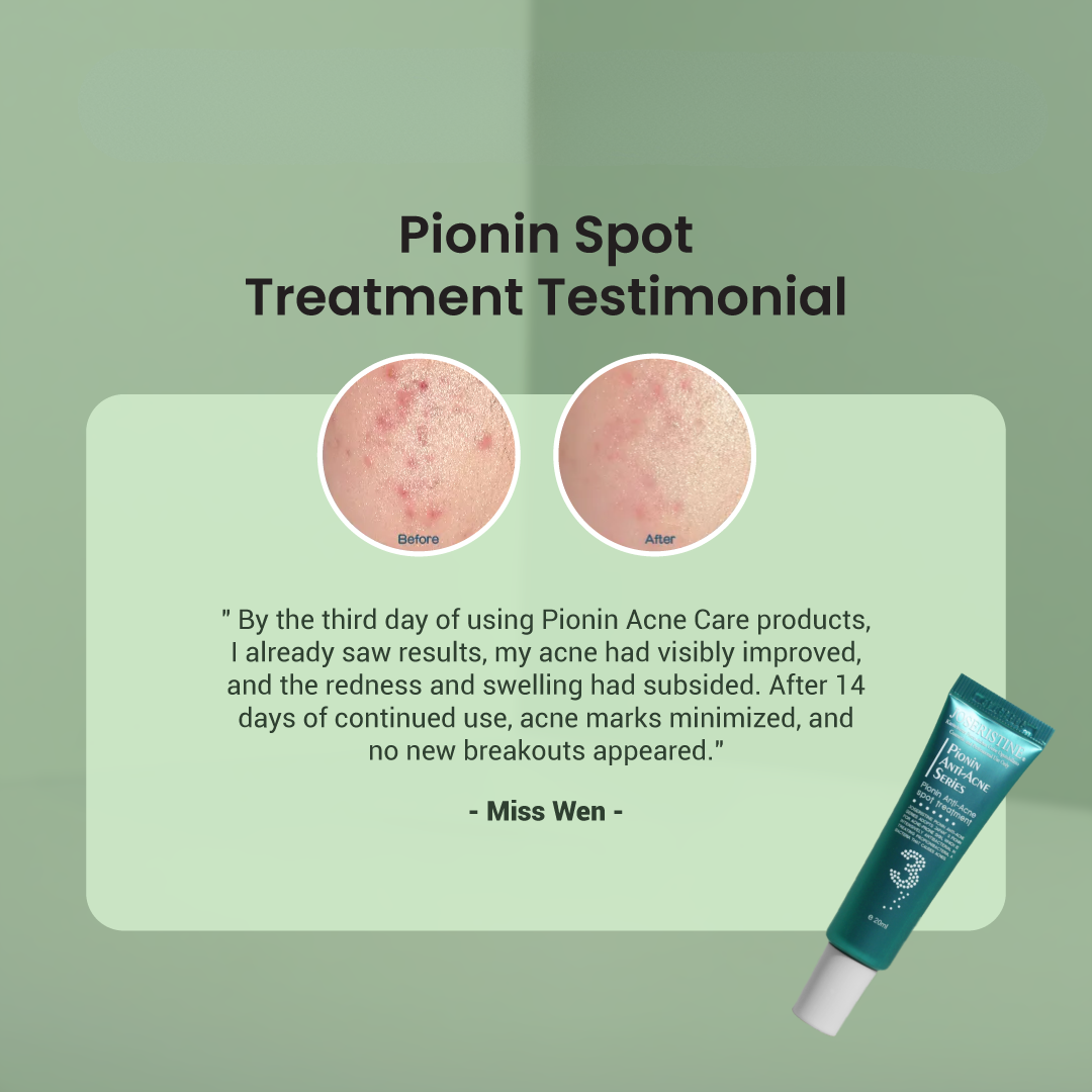 JOSERISTINE Pionin Acne Clear Blemish Clearing Cream 20ml