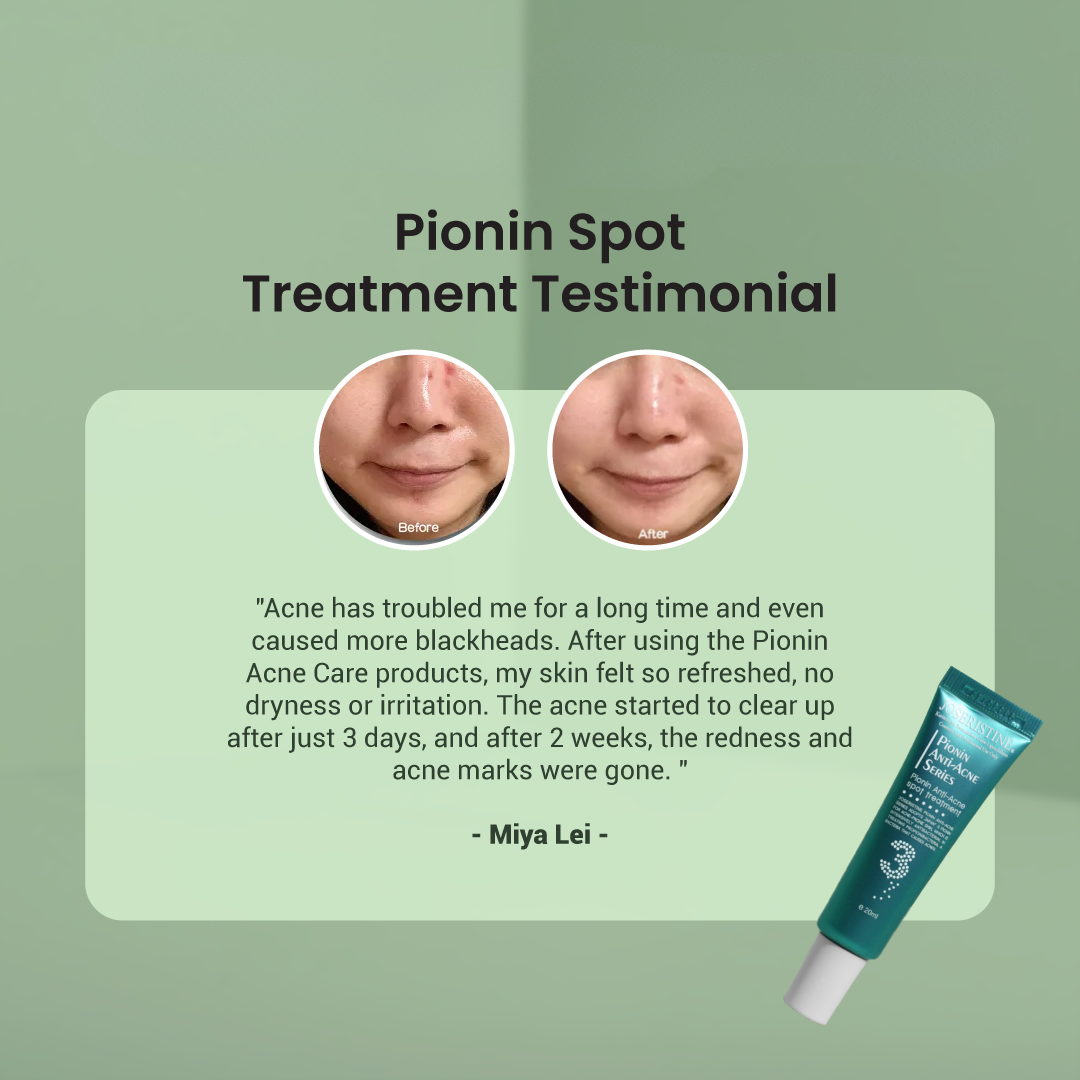 JOSERISTINE Pionin Acne Clear Blemish Clearing Cream 20ml