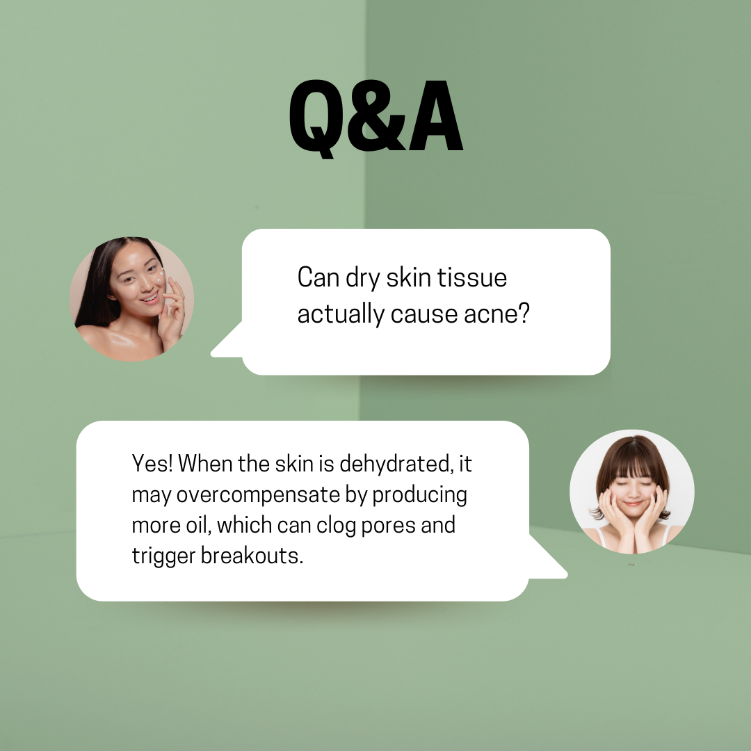 JOSERISTINE Pionin Anti-Acne Clarifying Toner 150ml