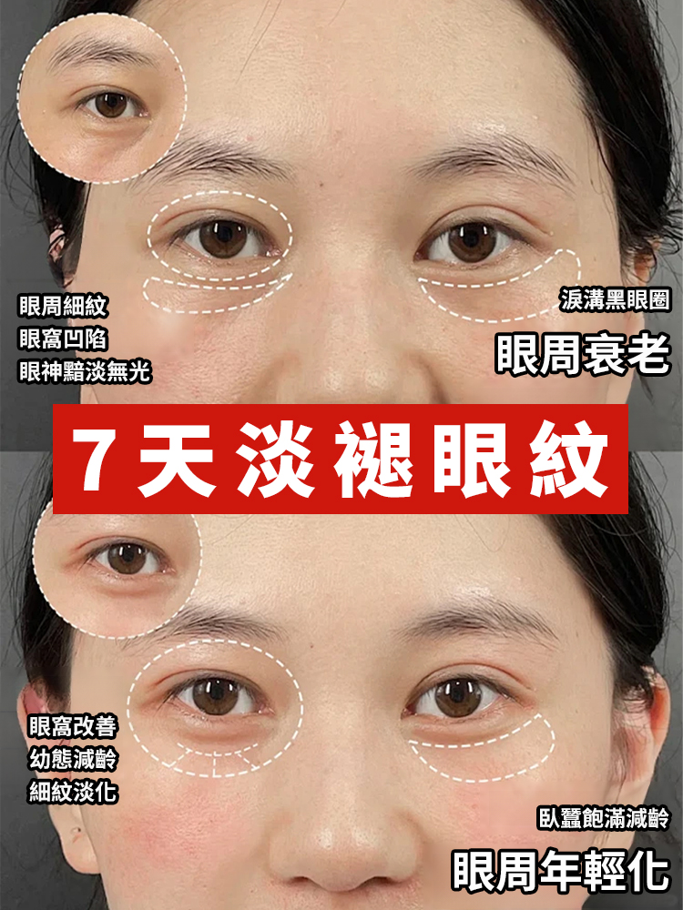 米蘭創新科學實驗室研發。每天睡前塗一塗，哪裡有紋塗哪裡，KO眼紋黑眼圈