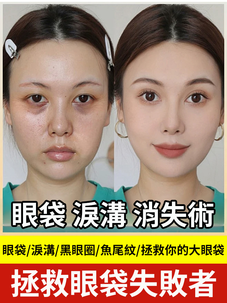 米蘭創新科學實驗室研發。每天睡前塗一塗，哪裡有紋塗哪裡，KO眼紋黑眼圈