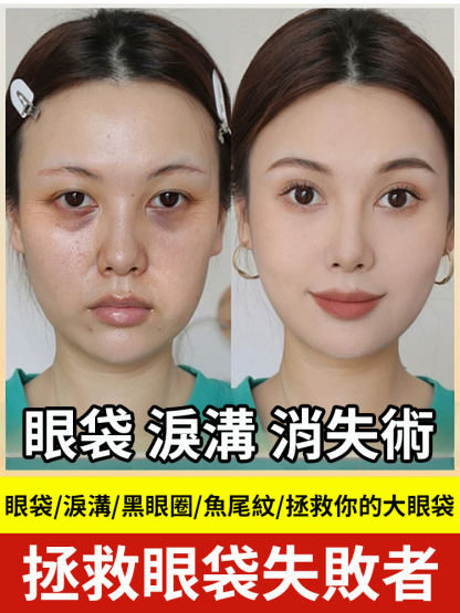 米蘭創新科學實驗室研發。每天睡前塗一塗，哪裡有紋塗哪裡，KO眼紋黑眼圈