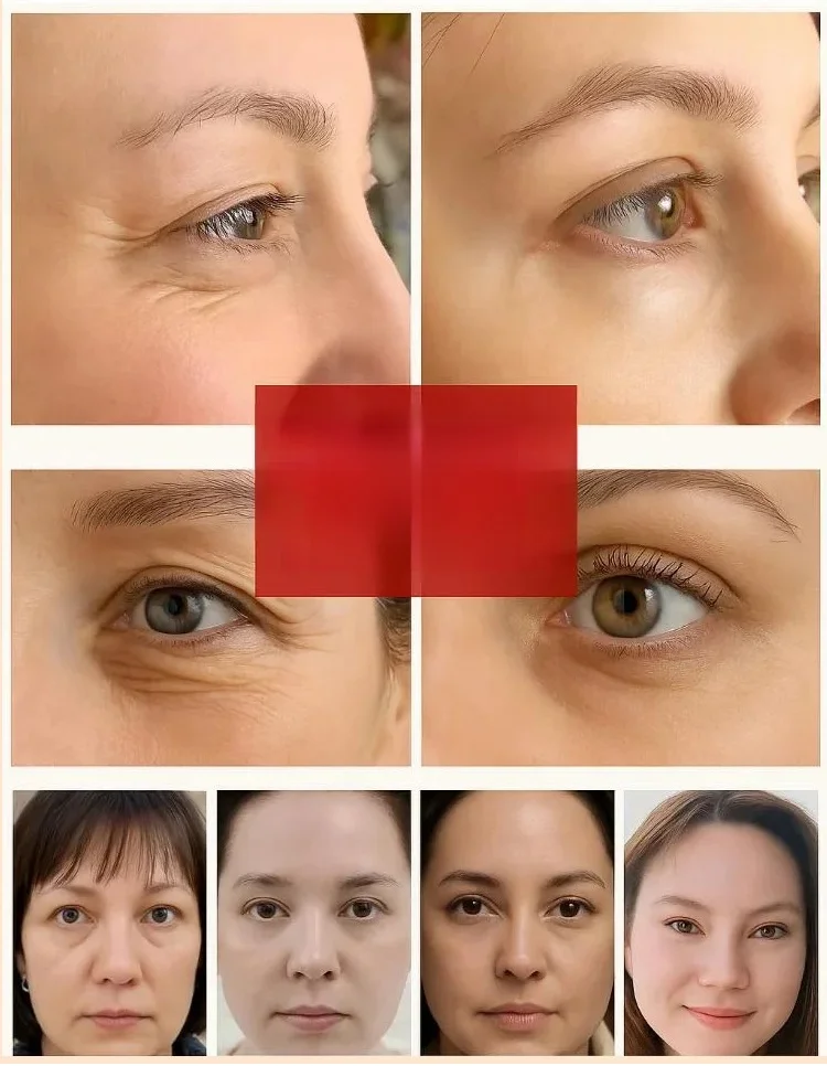 【Eye Line Eraser】Firming Eye Roller Oil