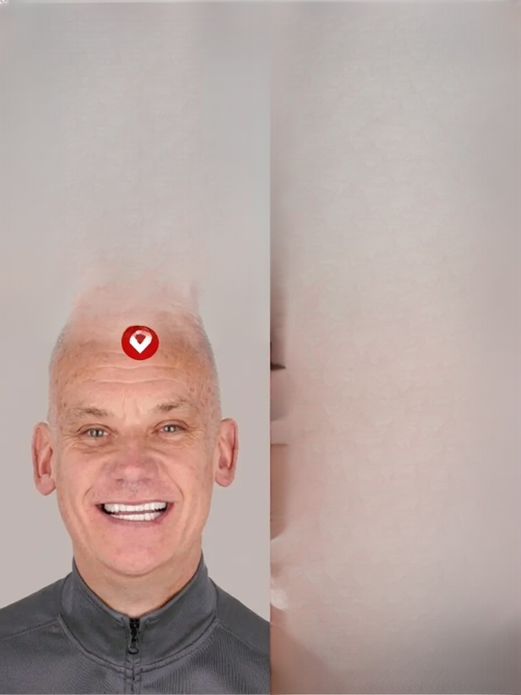 FDA Certified Whitening Mouth Tray, Full Fit, Comfortable and Natural