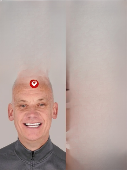 FDA Certified Whitening Mouth Tray, Full Fit, Comfortable and Natural