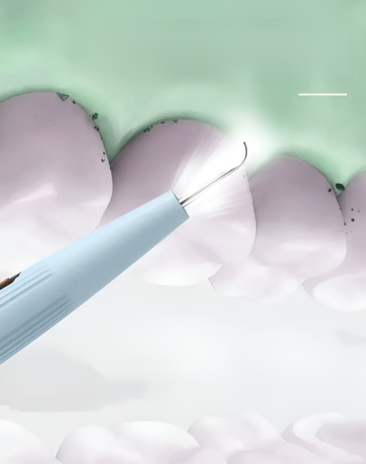 【Remove dental plaque】Ultrasonic electric toothbrush