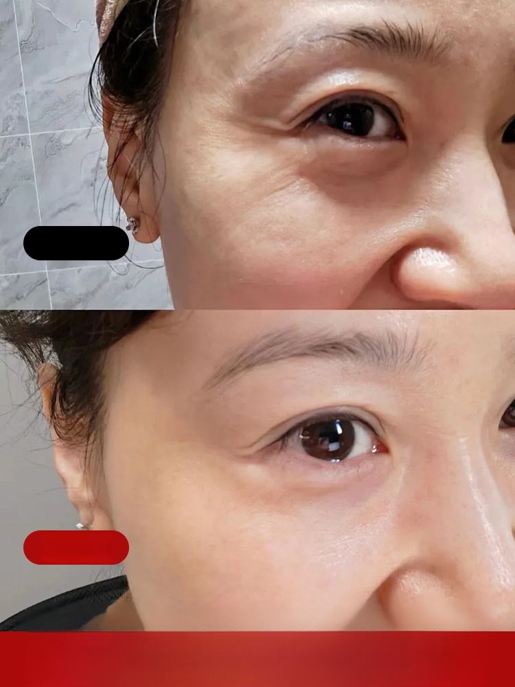 瘋搶爆單！ 7 天眼部抗皺神油來了！人蔘 + 蟲草黃金配方，24K 金箔促滲，乾紋細紋 7 天隱形，小分子精華油一抹吸收不粘膩，熟齡肌狂囤，手慢無！