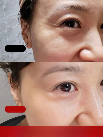 瘋搶爆單！ 7 天眼部抗皺神油來了！人蔘 + 蟲草黃金配方，24K 金箔促滲，乾紋細紋 7 天隱形，小分子精華油一抹吸收不粘膩，熟齡肌狂囤，手慢無！