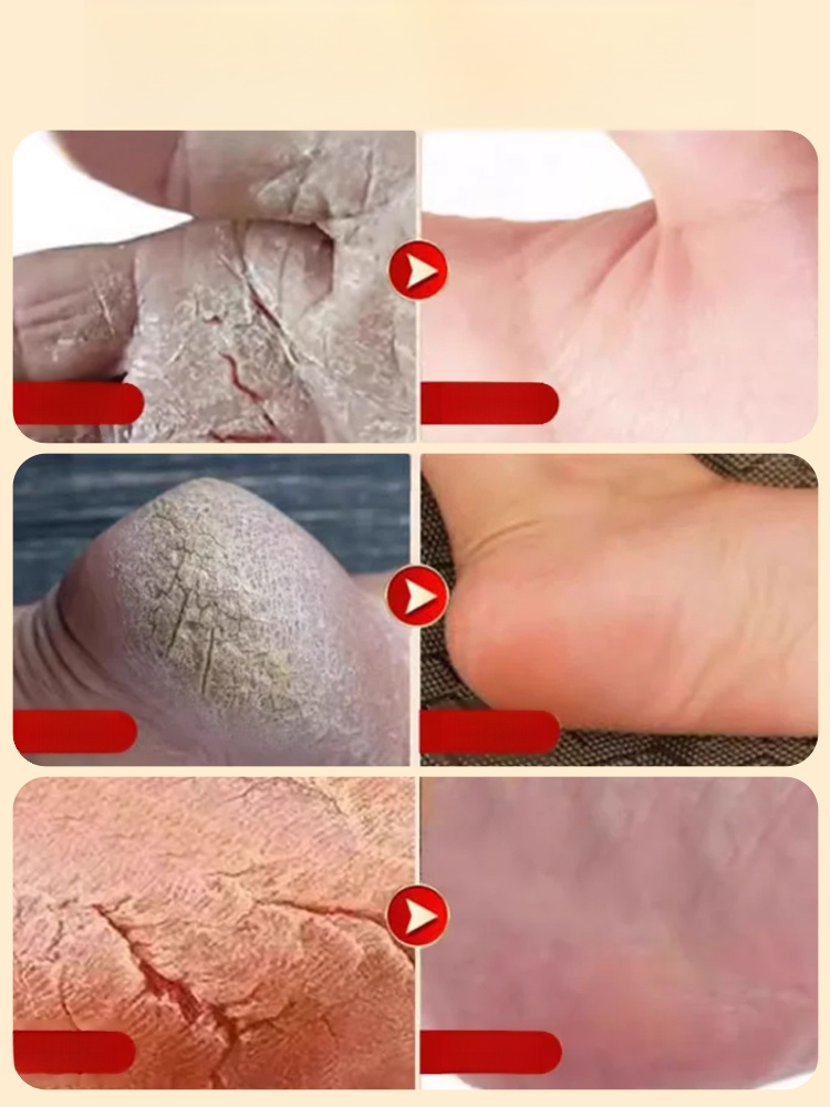 爆赞到回购爆表！胶原蛋白维 C 护手霜一抹水嫩，7 天淡指关节细纹，长效保湿不黏腻，还带淡雅香氛，通勤补涂超方便，家务族、上班族闭眼冲，库存告急！