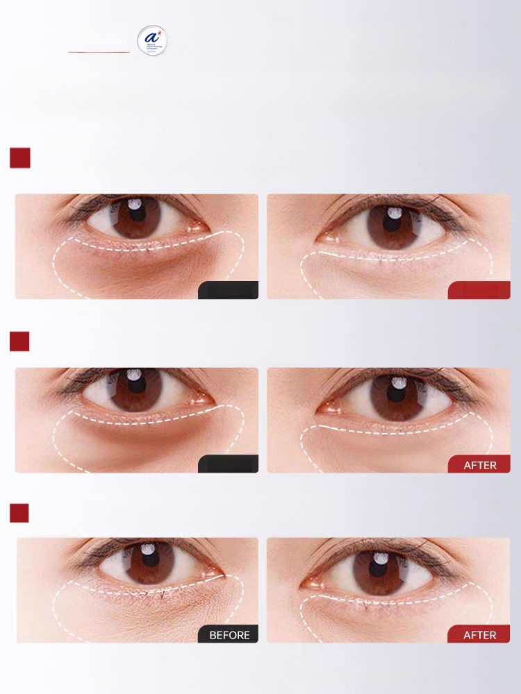 瘋搶爆單！ 7 天眼部抗皺神油來了！人蔘 + 蟲草黃金配方，24K 金箔促滲，乾紋細紋 7 天隱形，小分子精華油一抹吸收不粘膩，熟齡肌狂囤，手慢無！