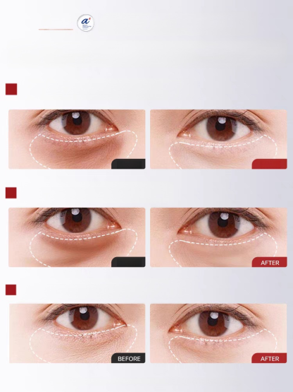 瘋搶爆單！ 7 天眼部抗皺神油來了！人蔘 + 蟲草黃金配方，24K 金箔促滲，乾紋細紋 7 天隱形，小分子精華油一抹吸收不粘膩，熟齡肌狂囤，手慢無！