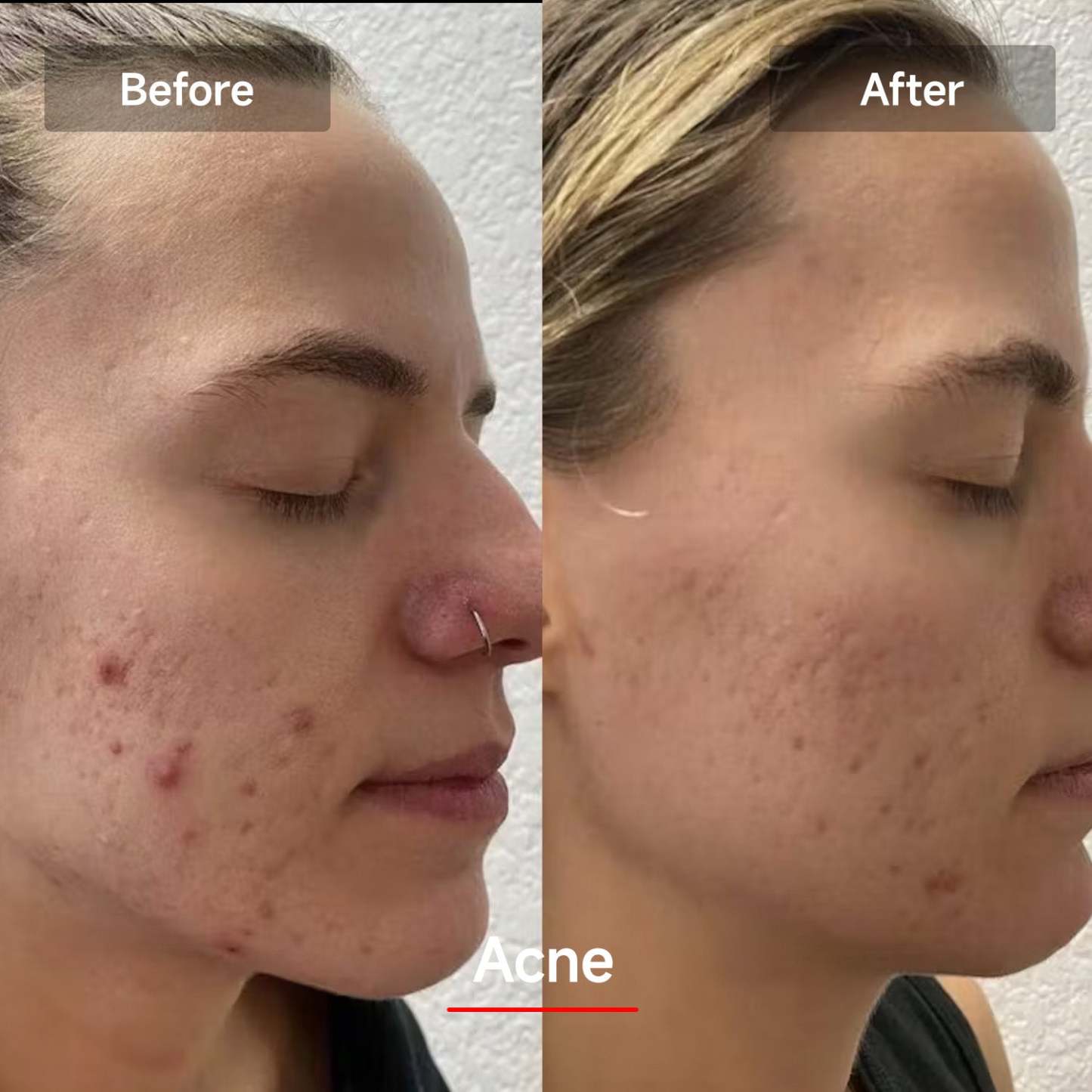 Veonskin LED Face Mask Pro – 7-Color Light Therapy for Skincare