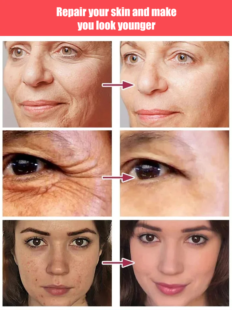 Recombinant Collagen Anti-Wrinkle Serum