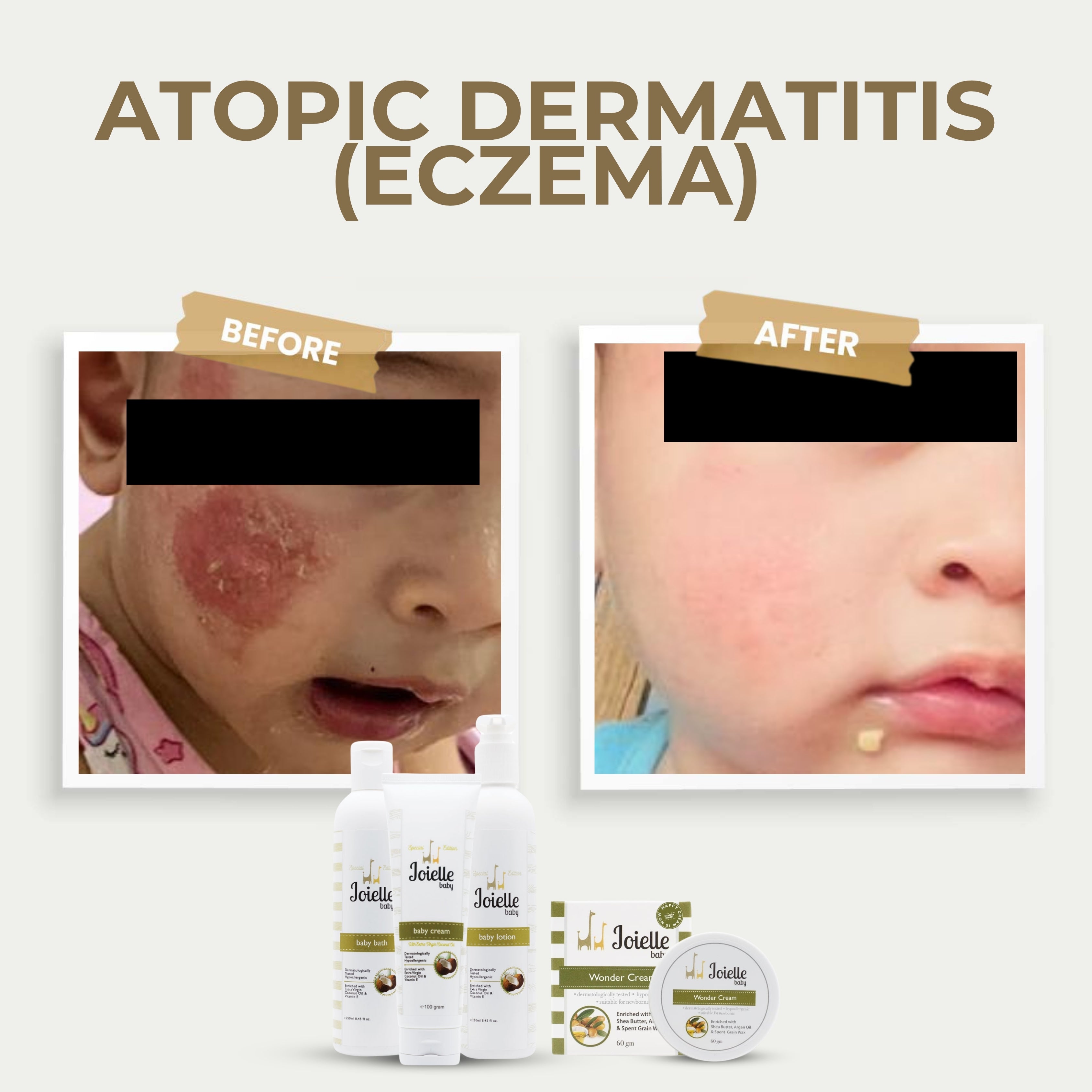 {"default":"testimoni naja 1 (3).jpg__PID:7917dd12-84da-4690-8d8c-22f7a1a2106a"}
