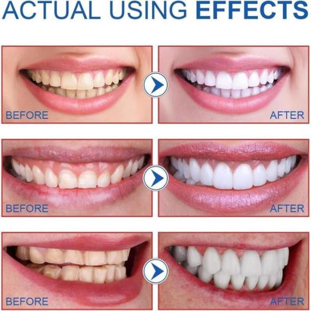 🔥2024 New Upgraded SP-6 Toothpaste Oral Health Management, Fresh Breath