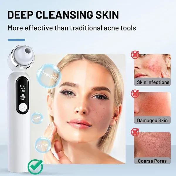 2024 Upgraded USB Interface Type Pore Vacuum with Camera