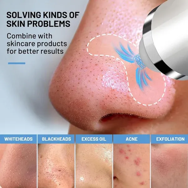 2024 Upgraded USB Interface Type Pore Vacuum with Camera