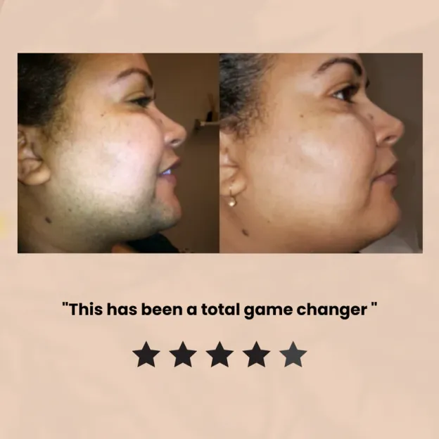 🌟LAST CHANCE! SPRING SALE🌟 Hair Removal Kit for Women - 🔥Buy 1 Get 1 Free🔥