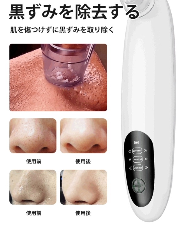 黒頭洗浄器