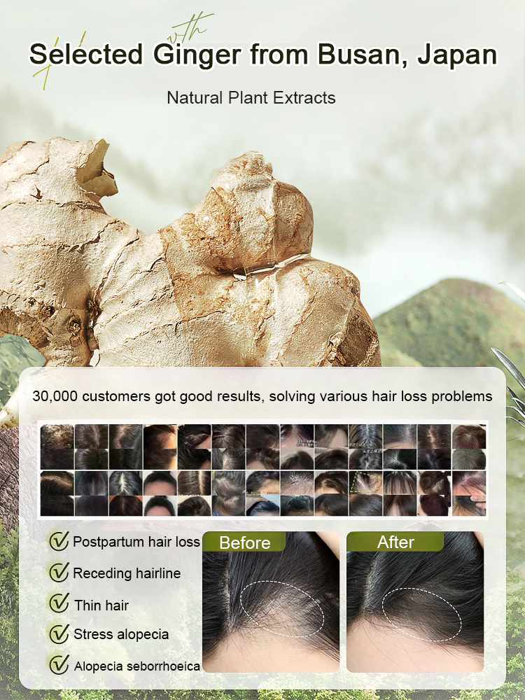 Hot Sale Ginger Plant Extract Anti-Hair Loss Hair Shampoo
