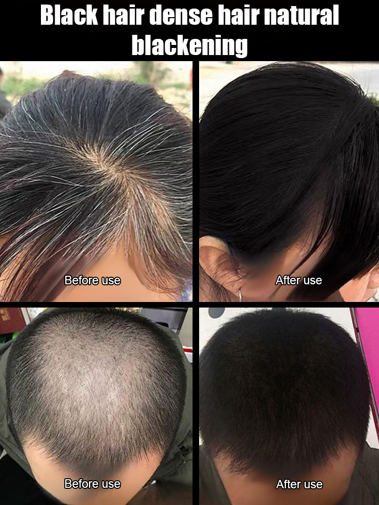 Cordyceps Oil-Control Shampoo [The More You Wash, The Darker Your Hair]