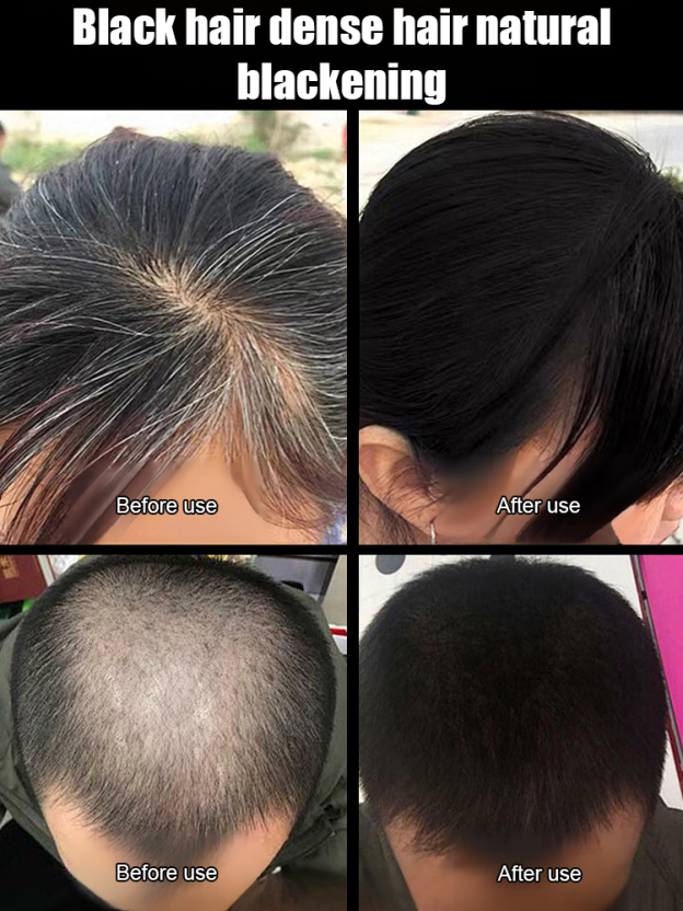 Cordyceps Oil-Control Shampoo [The More You Wash, The Darker Your Hair]