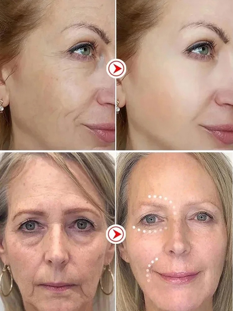 🌟✨ ด้วยครีมขมิ้น ที่รวมทุกคุณสมบัติในการดูแลผิวไว้ในกระปุกเดียว จบทุกปัญหาผิว: 👋 ลาก่อนรอยด่างดำ และปัญหาผิวอื่นๆ!