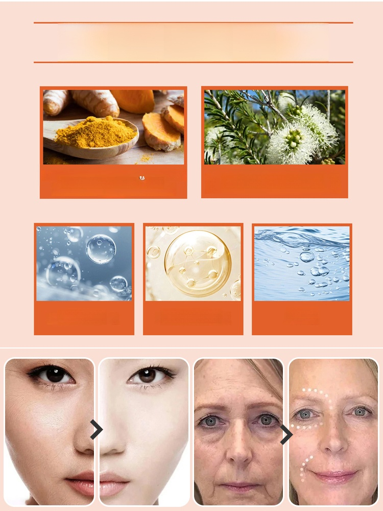 🌟✨ ด้วยครีมขมิ้น ที่รวมทุกคุณสมบัติในการดูแลผิวไว้ในกระปุกเดียว จบทุกปัญหาผิว: 👋 ลาก่อนรอยด่างดำ และปัญหาผิวอื่นๆ!